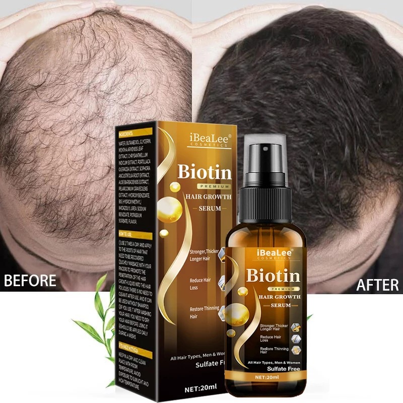Hair care solution, strong hai – Roots Nutrition & Fitness Inglewood Photos recenzja i cena