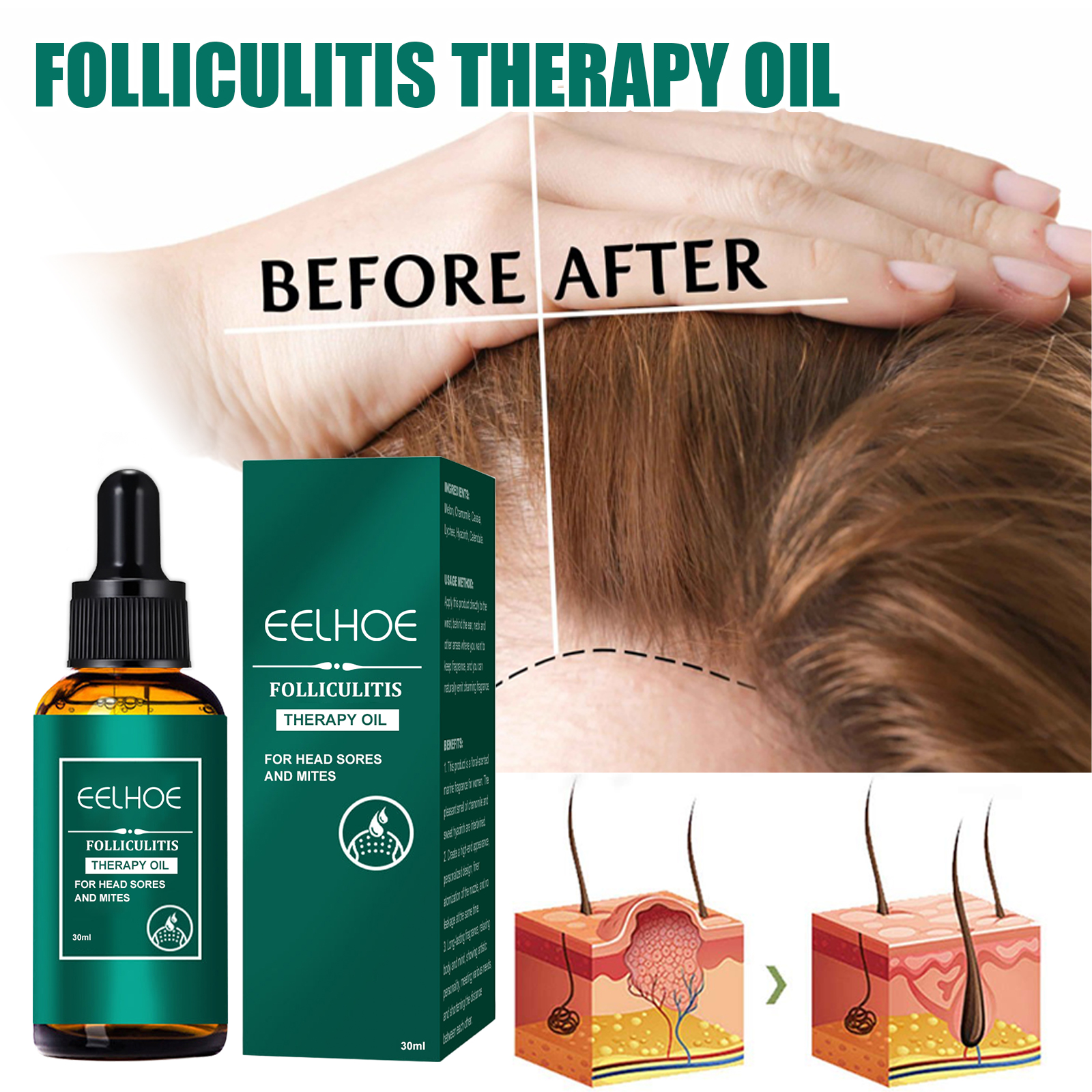 Scalp Treatment Serum Follicle – Roots Nutrition & Fitness Inglewood Photos recenzja i cena