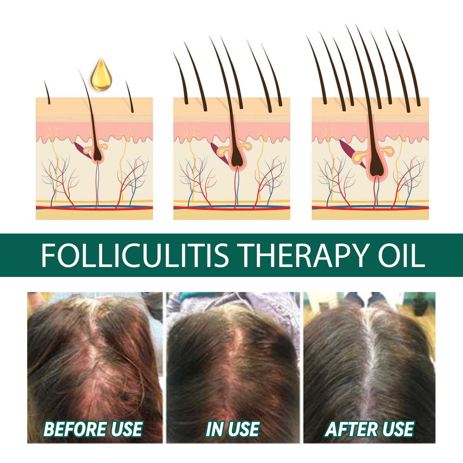 Scalp Treatment Serum Follicle – Roots Nutrition & Fitness Inglewood Photos recenzja i cena